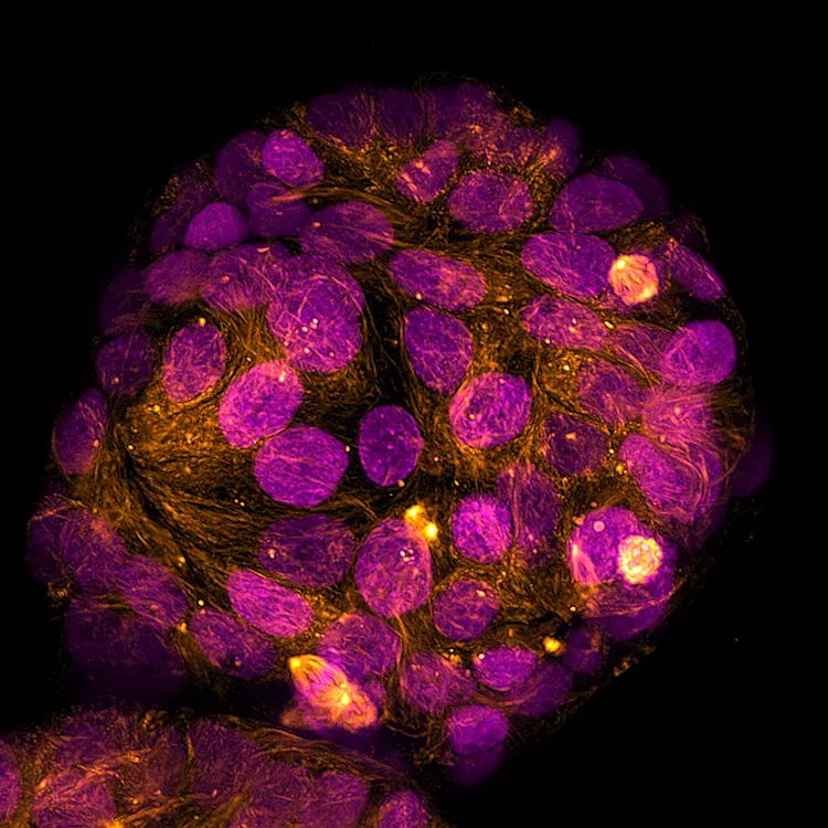 Horace Chan Horace Chan