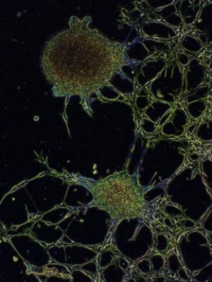 Neurogenesis by Kharen Doyle, Garvan Institute of Medical Research