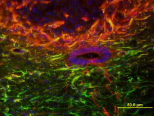 Neural Stem Cells in Spinal Cord Injury by Yilin Mao, University of Technology, Sydney